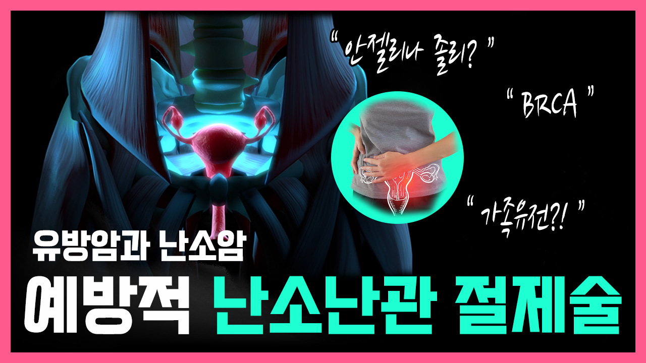유방암과 난소암! 예방적 난소난관 절제술 필요할까  