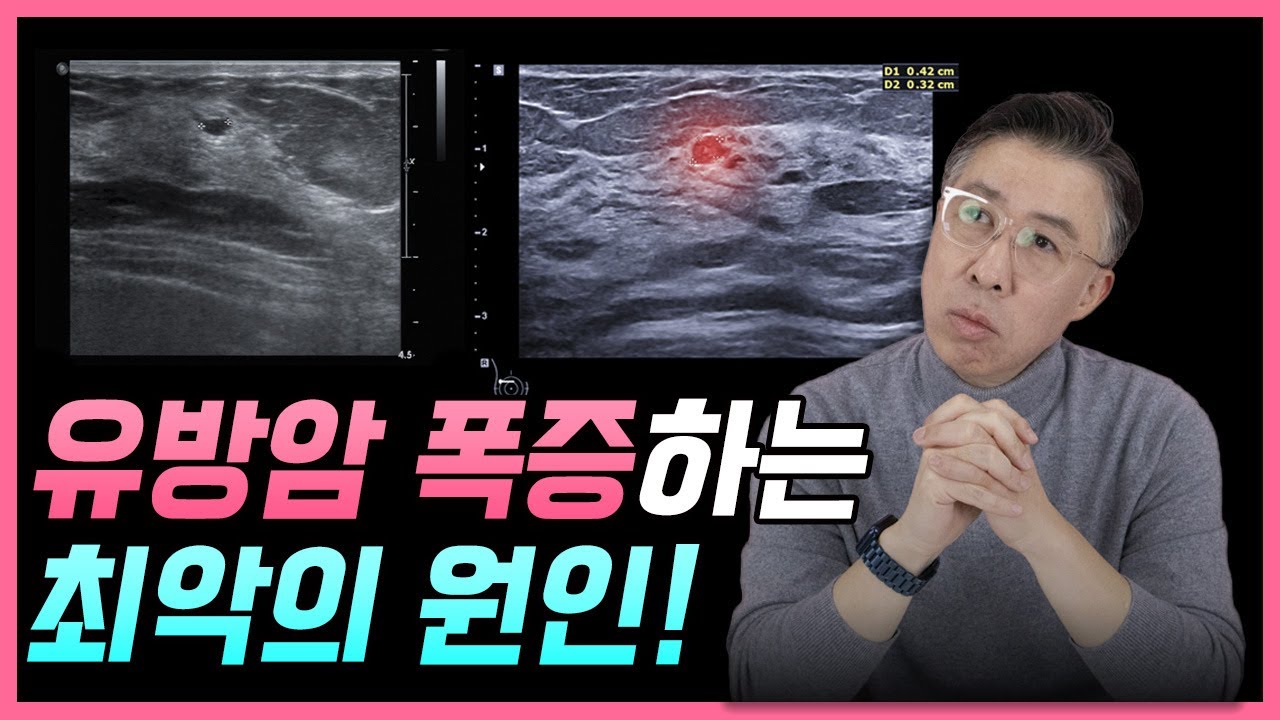 유방암 폭증하는 최악의 원인!  