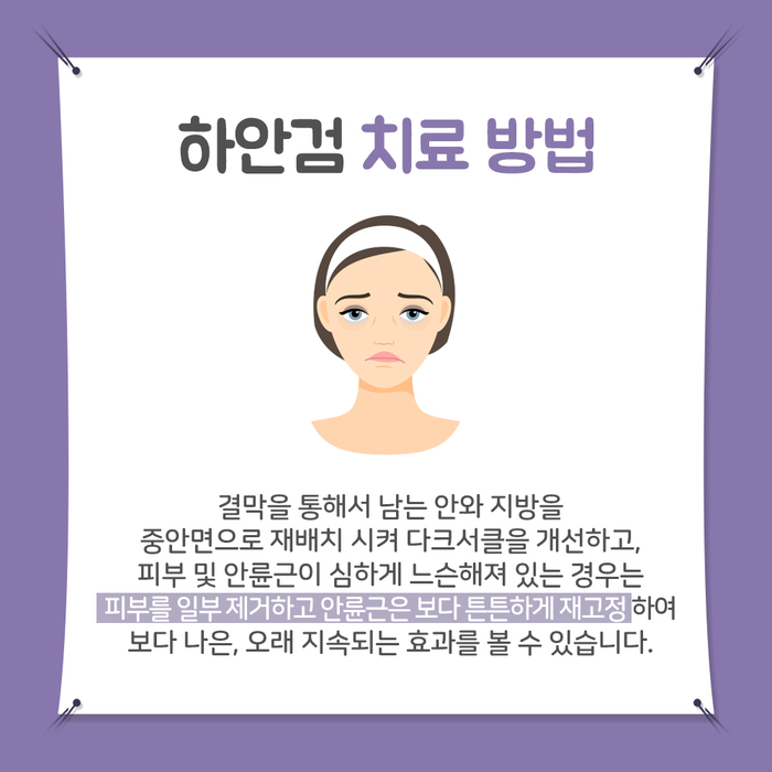 [성형외과] 하안검 4.jpg