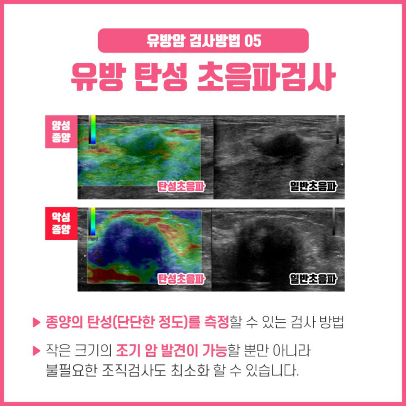 [유방센터] 유방암 검사방법 6.jpg