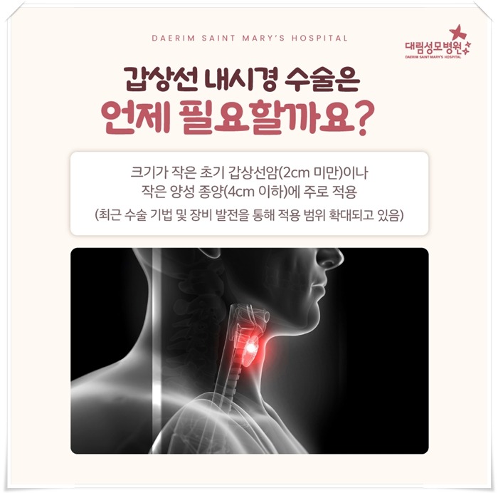 250430_대림성모병원_바이럴_갑상선내시경_(4)_(1).jpg